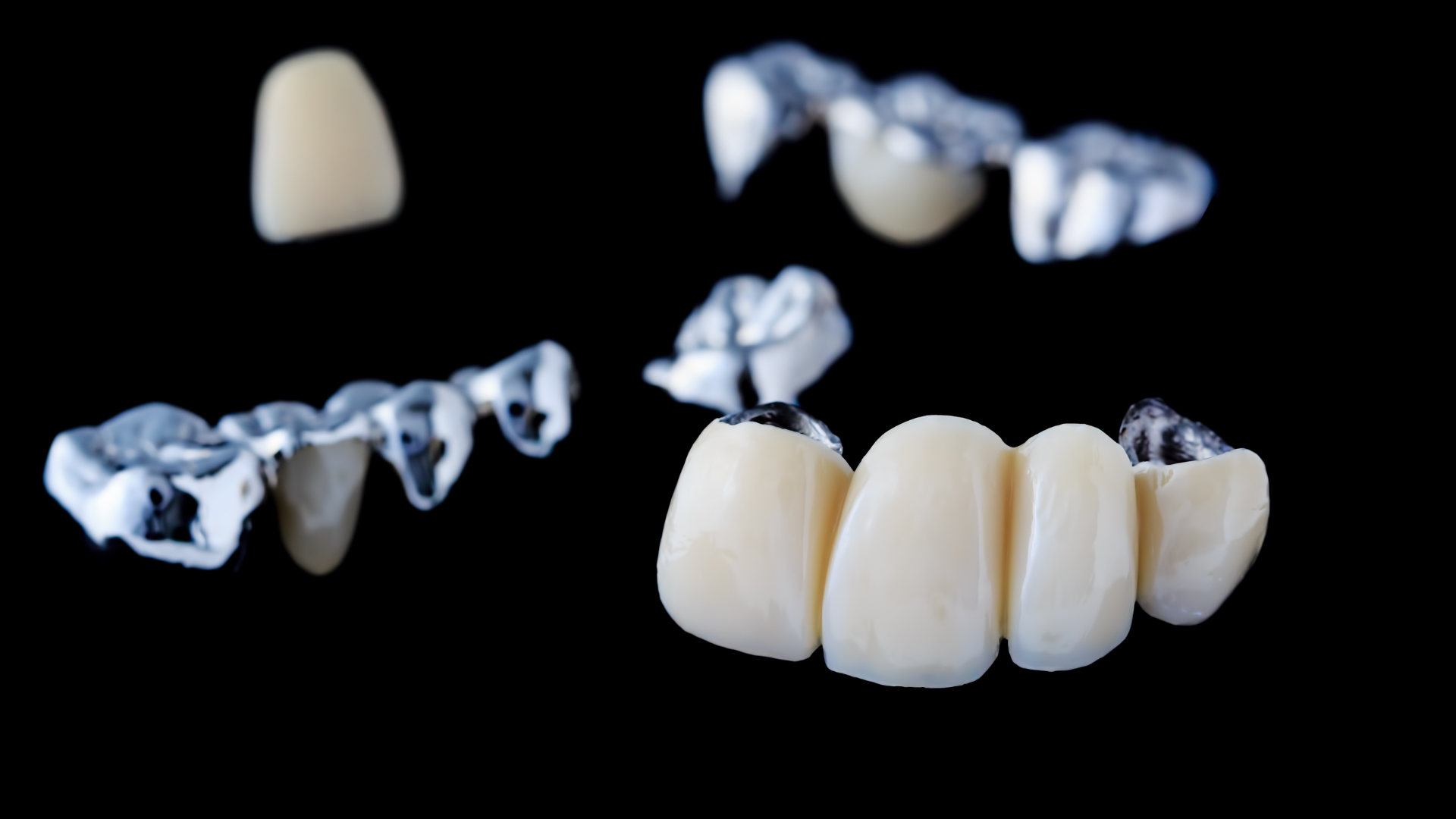 Everything You Need to Know About Dental Bridges